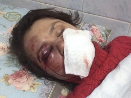 Ми обурені жорстоким побиттям журналістки Тетяни Чорновол та вимагаємо справедливості!