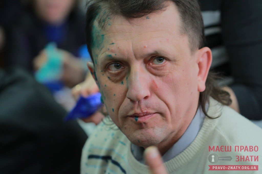 У «Свободі» розповіли, як відкликатимуть Здоровця та Кочубея з посад у міськраді